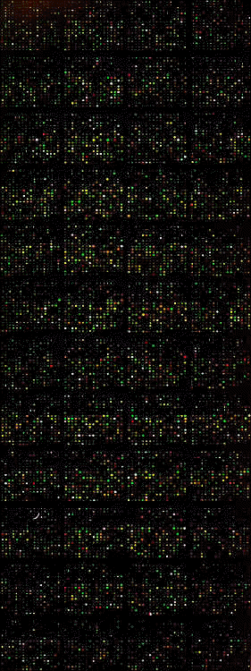 Labeled macrophage (Cy3) and liver
  (Cy5) cDNA hybridized to a 14,609 spot NHLBI-PGA mouse array.